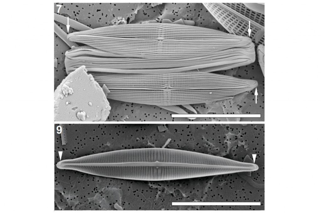 The Browder diatom (Proschkinia browderiana).